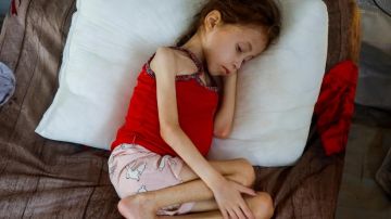 خمس وفيات نتيجة الجوع وسوء التغذية في غزة