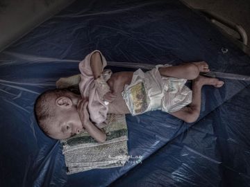 وفاة 3 أطفال في غزة بسبب سوء التغذية ونقص العلاج وفاة 3 أطفال في غزة بسبب سوء التغذية ونقص العلاج