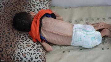 4 حالات وفاة نتيجة المجاعة وسوء التغذية في غزة 4 حالات وفاة نتيجة المجاعة وسوء التغذية في غزة