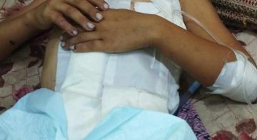 عائلة الطفل المصاب عبد الكريم السري تناشد بسرعة إجلاء طفلها للعلاج في الخارج