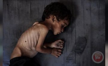 6 وفيات جديدة بسبب التجويع بغزة خلال 24 ساعة