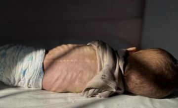 3 حالات وفاة جديدة جراء سوء التغذية والمجاعة في غزة