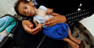 تقرير على أسرة المرض.. طفولة تخوض معركة بقاء في غزة
