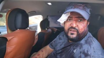 إصابة فلسطينيين وصحافية أمريكية في هجوم لمستوطنين إسرائيليين خلال قطف الزيتون بالضفة الغربية المحتلة إصابة فلسطينيين وصحافية أمريكية في هجوم لمستوطنين إسرائيليين خلال قطف الزيتون بالضفة الغربية المحتلة