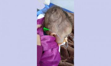 تقرير 24 ساعة بين الحياة والموت.. أم تودع رضيعتها بعد رحلة علاج مؤجل