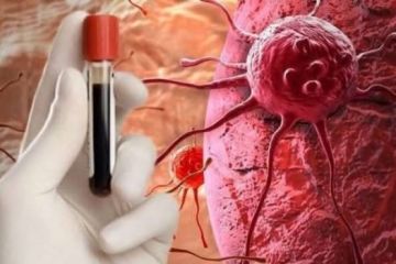 وزارة الصحة: زيادة عدد حالات السرطان الجديدة في الضفة الغربية