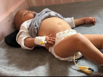  يزن أبو ظريفة حين تصارع الطفولة المجاعة والمرض معا