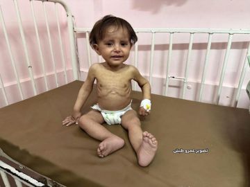 تقرير محمد زنون.. رضيع ولد في الحرب وتطارده أمراض الجوع