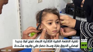أقنعة ثلاثية الأبعاد لعلاج مصابي الحروق أقنعة ثلاثية الأبعاد لعلاج مصابي الحروق