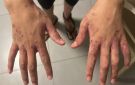 خاص وزارة الأسرى لـ شهاب: الاحتلال يفرض واقعا كارثيا داخل السجون ويتعمد نشر الأمراض وتجويع الأسرى والأسيرات