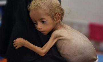 مسؤول طبي : نحو 1.6 مليون شخص مهددون بالمجاعة وسوء التغذية بغزة