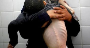خاص أبو سلمية لـ شهاب: الحرب والحصار يهددان أجيال غزة القادمة.. ارتفاع الإجهاض لـ 70 وتشوهات خلقية غير مسبوقة