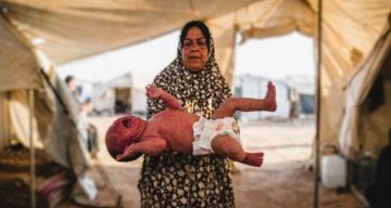 10 آلاف إصابة بجدري الماء ووفاة طفل وسط تدهور صحي متسارع في غزة 10 آلاف إصابة بجدري الماء ووفاة طفل وسط تدهور صحي متسارع في غزة
