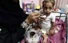 شاهد: التقزم والهزال يهددان أطفال غزة