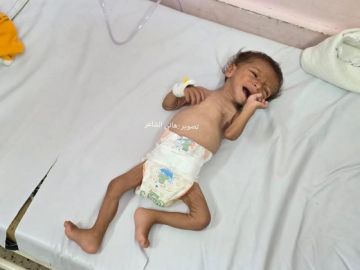 بعد مناشدات لإنقاذه.. وفاة طفل نازح في غزة عن 8 أشهر