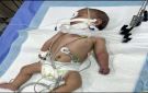 استشهاد رضيع في غزة بعد تعذر سفره لإجراء عملية قلب