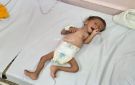 بعد مناشدات لإنقاذه.. وفاة طفل نازح في غزة عن 8 أشهر