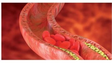 الصحة: أدوية الستاتين الخافضة للكولسترول آمنة