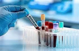 4 اختبارات دم أساسية بعد سن الأربعين.. مفتاح العيش بصحة حتى الـ100