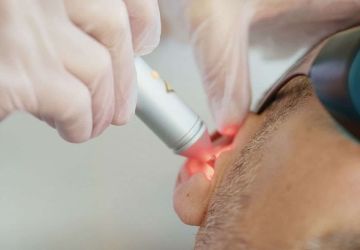 النمر يحذر من علاج الليزر للإقلاع عن التدخين: غير مثبت علميا ويسوق بأسعار مبالغ فيها