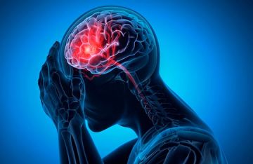 الجلطات الدماغية تتزايد بين الشباب.. أطباء يحذرون من نمط الحياة الحديث