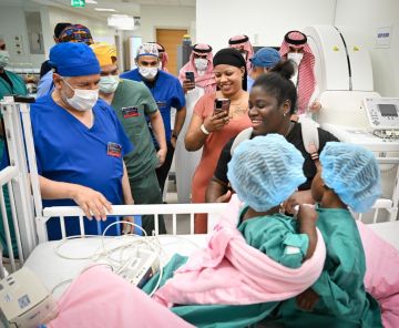 نجاح فصل التوأم الملتصق الجامايكي أزاريا وأزورا بالرياض