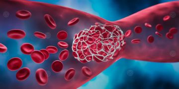 أبل تطلق تحديث iOS 26.1 بتحسينات تشمل الخصوصية والذكاء الاصطناعي أبل تطلق تحديث iOS 26.1 بتحسينات تشمل الخصوصية والذكاء الاصطناعي