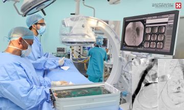 مستشفى الدكتور سليمان الحبيب بالقصيم يعالج جلطات وانسدادات ضخمة في الوريد الفخذي بالأشعة التداخلية