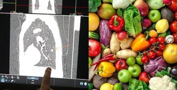 النظام الغذائي وسرطان الرئة.. دراسة تكشف علاقة استبعدتها الأبحاث في الماضي النظام الغذائي وسرطان الرئة.. دراسة تكشف علاقة استبعدتها الأبحاث في الماضي