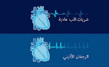 مصنوعة بالذكاء الاصطناعي.. قلوب رقمية متليفة تساعد في علاج الرجفان الأذيني مصنوعة بالذكاء الاصطناعي.. قلوب رقمية متليفة تساعد في علاج الرجفان الأذيني