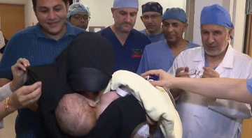 الطفل محمد بين يدي والدته.. شاهد لحظات إنسانية بعد نجاح فصل التوأم الطفيلي المصري