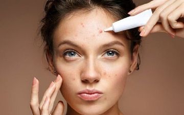 لا تشخيص ولا علاج دون استشارة طبيب.. متى يكون الطفح الجلدي على الوجه مشكلة بسيطة أو علامة على مرض خفي؟