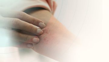 في اليوم العالمي لـ الذئبة الحمراء.. جهود وطنية لتعزيز الوعي بمرض مناعي مزمن يهدد الأعضاء الحيوية