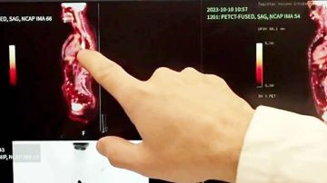 علاج ثوري للسرطان: تقنية نانوية تستهدف الخلايا بدقة دون جراحة