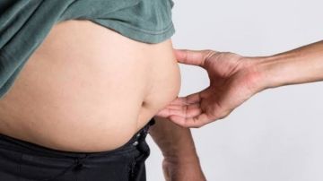 استشاري يحذر: شد الترهلات بعد التكميم يسبب مضاعفات خطيرة .. فيديو