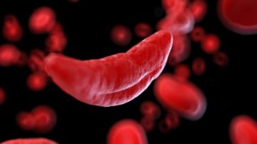 بقنة: فقر الدم المنجلي لا يصيب الدم فقط بل يطال كل عضو تقريبا .. فيديو