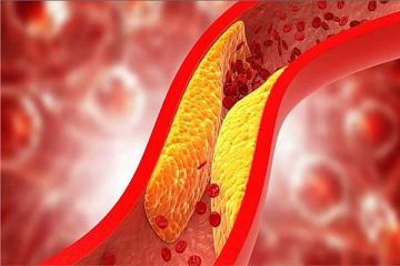 النمر يكشف العلاقة الأقوى بين الكوليسترول الجيد وجلطات القلب.. ويحدد طرق رفعه طبيعيا