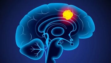 اختراق طبي رائع.. اختفاء سرطان الدماغ من أب بريطاني في تجربة دواء جديد