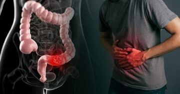 الخضيري: الإمساك آفة العصر ويؤدي للقلق والسمنة.. وهذه وصفة الوقاية