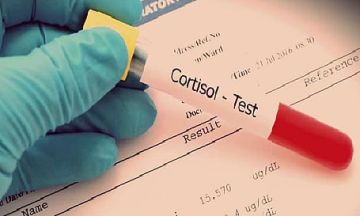 من أجل صحتك.. خبراء: 5 أطعمة لذيذة تخفض الكورتيزول الضار