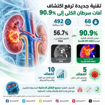 تقنية تصوير جديدة تعزز اكتشاف آفات سرطان الكلى الصافي تقنية تصوير جديدة تعزز اكتشاف آفات سرطان الكلى الصافي