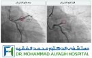 أقل من 50 دقيقة تنقذ حياة ثمانيني.. الحضور المبكر وسرعة الاستجابة تنقذان القلب