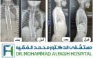 مستشفى الدكتور محمد الفقيه يعالـج الجنف المبكر لطفل