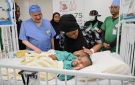 بدء عملية فصل التوأم الملتصق التنزاني لايتيينس ولوفنس في الرياض.. صور - sa