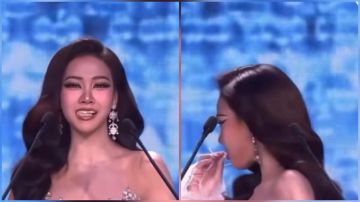 أخصائي: الشاي والقهوة قد يتسببان بسقوط تركيبات الأسنان المتحركة.. فيديو