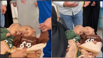 وصول التوأم السيامي الباكستاني سفيان ويوسف إلى الرياض.. فيديو