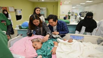 بدء عملية فصل التوأم الملتصق الفلبيني كليا وموريس آن في الرياض