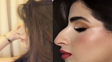 خلود العمري توثق ملامحها قبل وبعد تجميل الأنف خلود العمري توثق ملامحها قبل وبعد تجميل الأنف