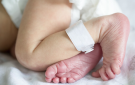 طفل يولد بـ4 أذرع و4 أرجل في الهند.. والأطباء يكشفون سر الحالة