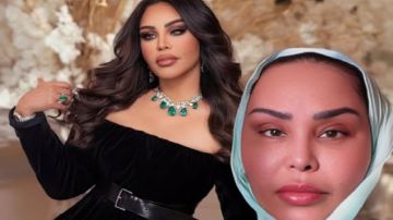 أحلام تظهر بالحجاب بعد خضوعها لشد الوجه ..صورة